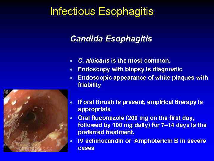 Infectious Esophagitis Candida Esophagitis · C. albicans is the most common. · Endoscopy with