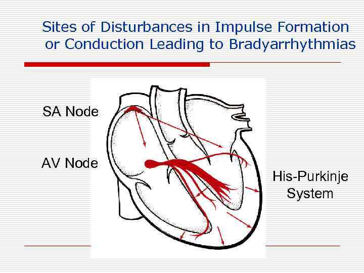 Sites of Disturbances in Impulse Formation or Conduction Leading to Bradyarrhythmias SA Node AV