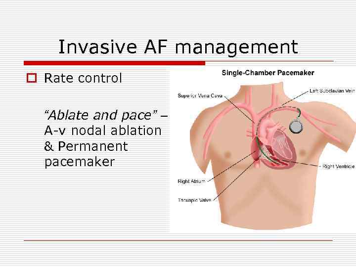 Invasive AF management o Rate control “Ablate and pace” – A-v nodal ablation &