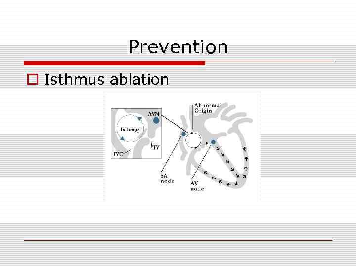 Prevention o Isthmus ablation 