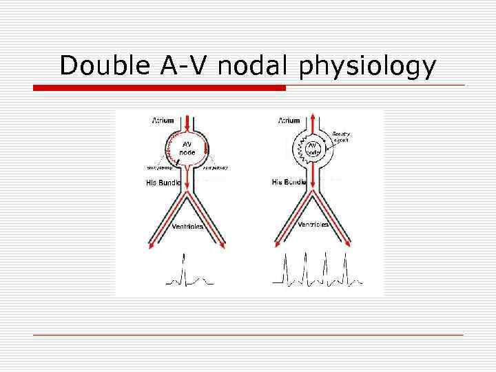 Double A-V nodal physiology 