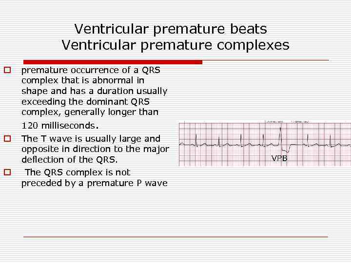 Ventricular premature beats Ventricular premature complexes o premature occurrence of a QRS complex that