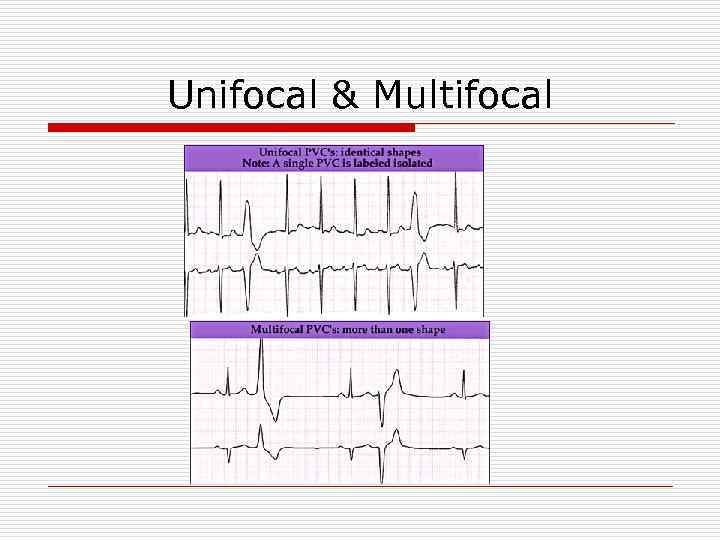 Unifocal & Multifocal 