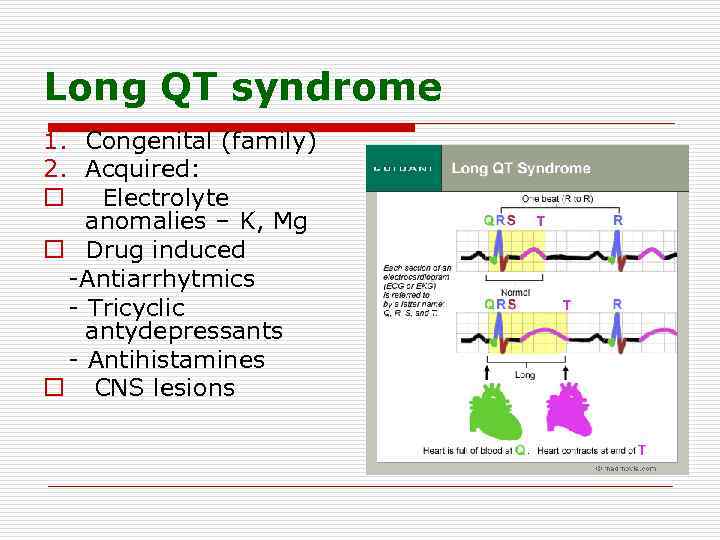 Long QT syndrome 1. Congenital (family) 2. Acquired: o Electrolyte anomalies – K, Mg