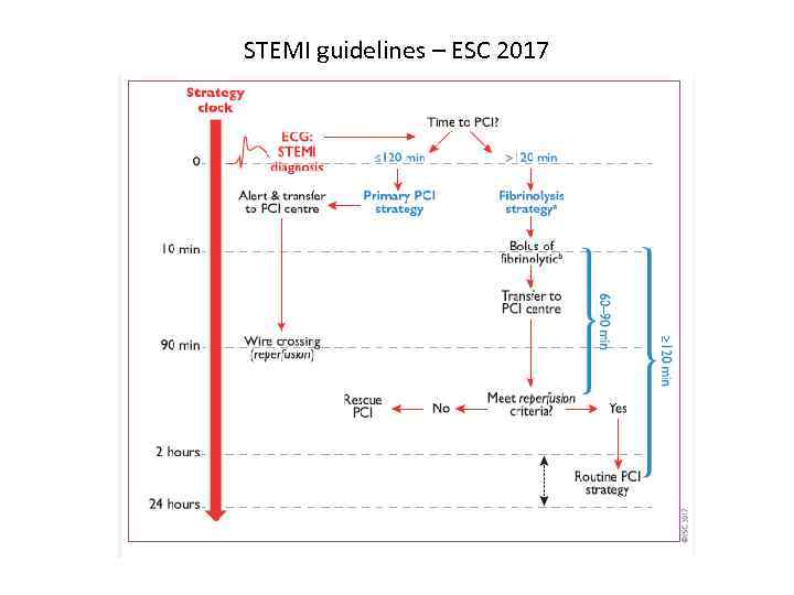 STEMI guidelines – ESC 2017 