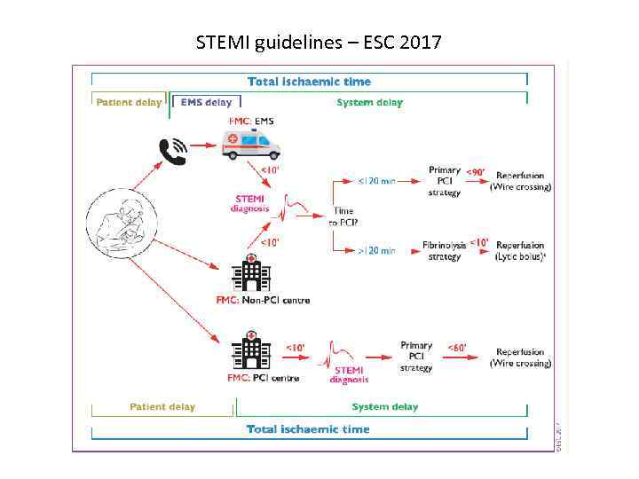 STEMI guidelines – ESC 2017 