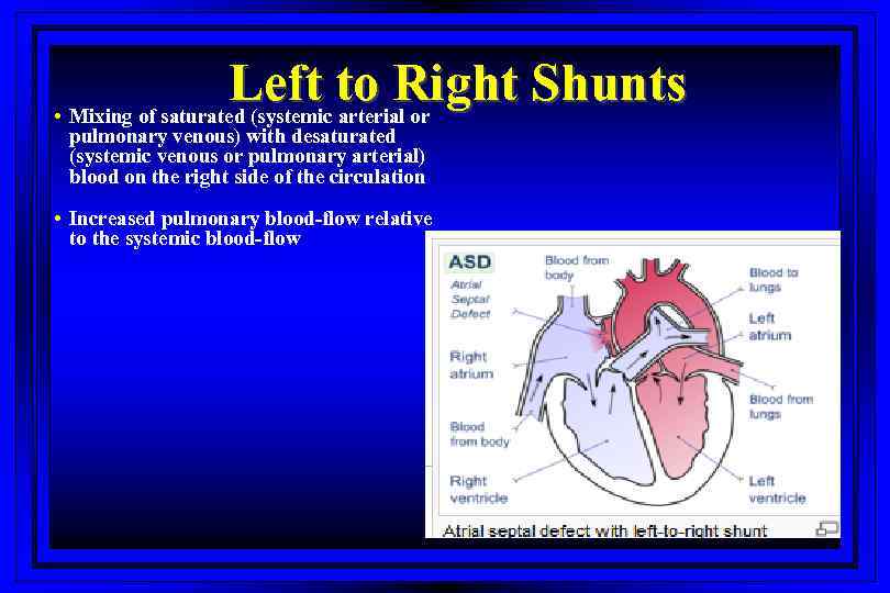 Left to Right Shunts • Mixing of saturated (systemic arterial or pulmonary venous) with