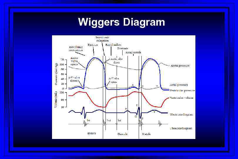 Wiggers Diagram 