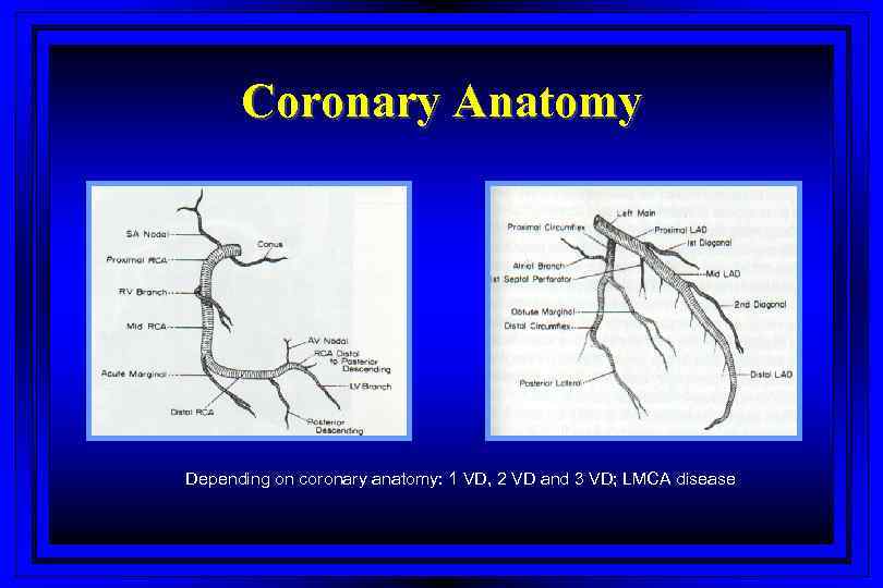 Coronary Anatomy Depending on coronary anatomy: 1 VD, 2 VD and 3 VD; LMCA