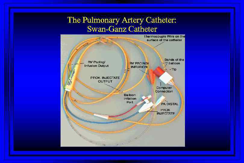 The Pulmonary Artery Catheter: Swan-Ganz Catheter 