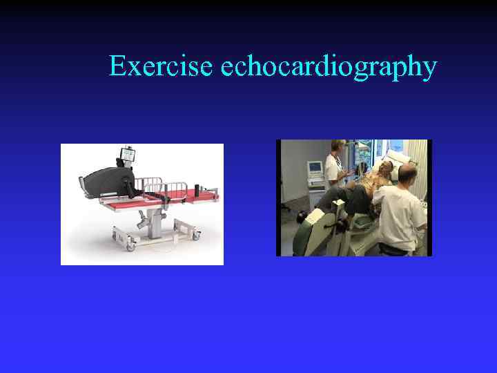 Exercise echocardiography 