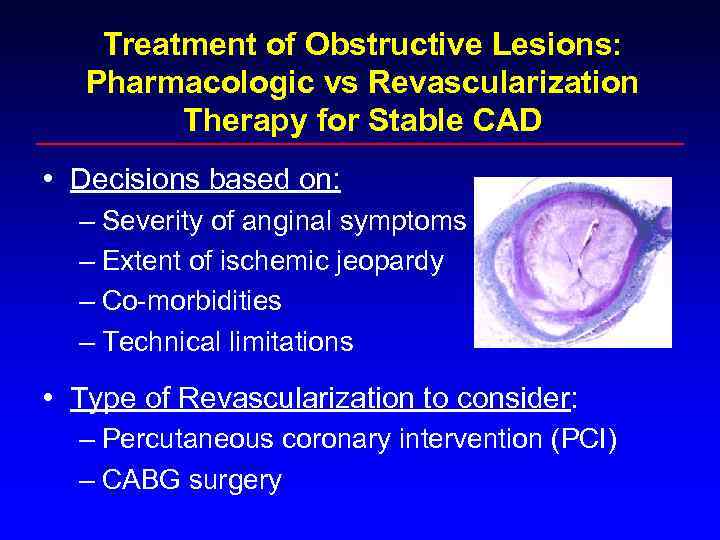 Treatment of Obstructive Lesions: Pharmacologic vs Revascularization Therapy for Stable CAD • Decisions based