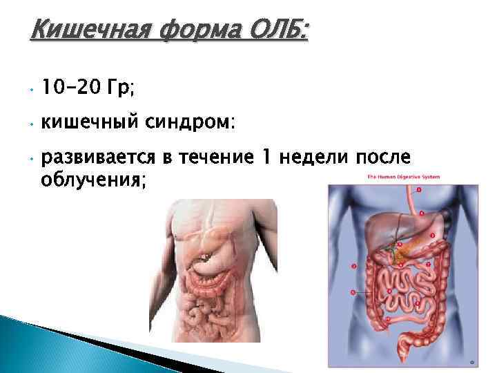 Кишечная форма ОЛБ: • 10 -20 Гр; • кишечный синдром: • развивается в течение