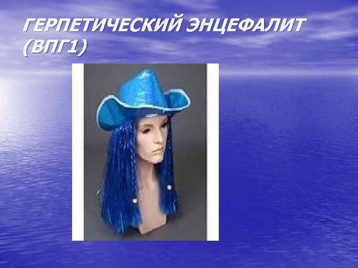 ГЕРПЕТИЧЕСКИЙ ЭНЦЕФАЛИТ (ВПГ 1) 