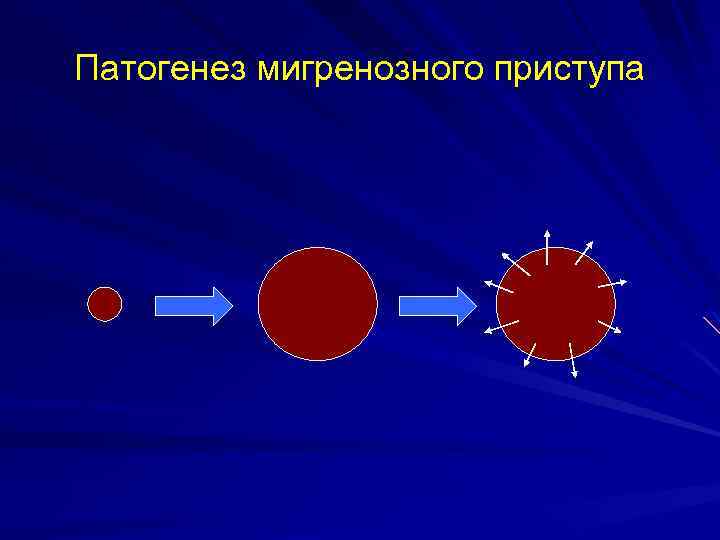 Патогенез мигренозного приступа 