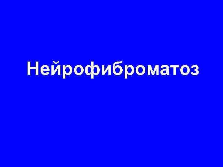 Нейрофиброматоз 