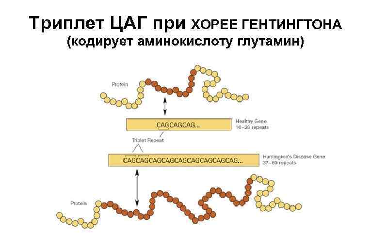 Триплет ЦАГ при ХОРЕЕ ГЕНТИНГТОНА (кодирует аминокислоту глутамин) 