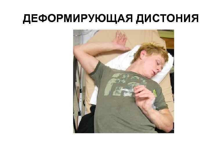 ДЕФОРМИРУЮЩАЯ ДИСТОНИЯ 