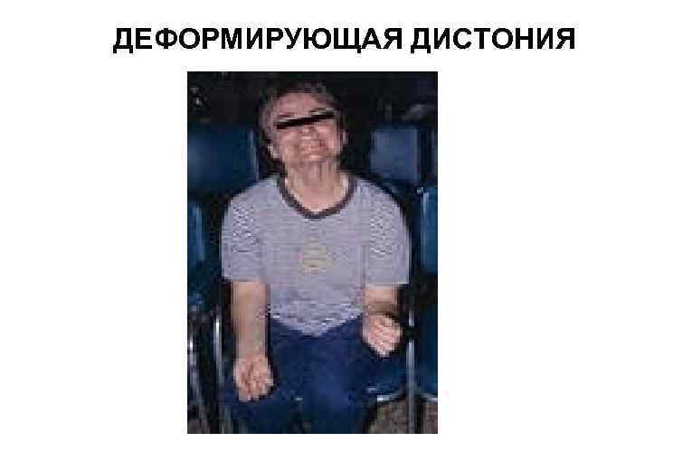 ДЕФОРМИРУЮЩАЯ ДИСТОНИЯ 