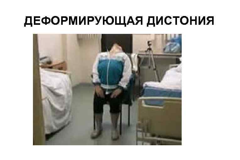 ДЕФОРМИРУЮЩАЯ ДИСТОНИЯ 
