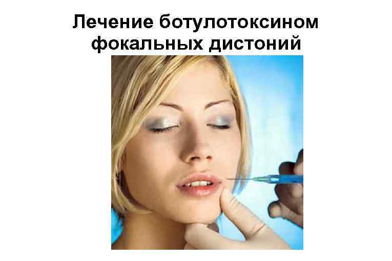 Лечение ботулотоксином фокальных дистоний 