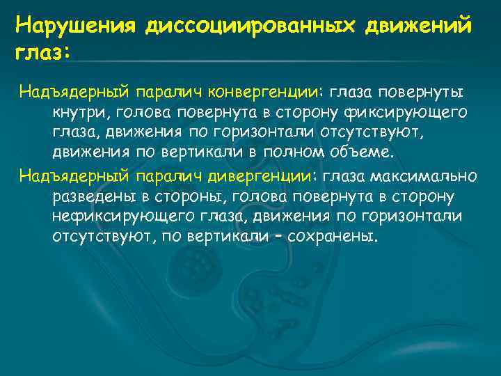 Нарушения диссоциированных движений глаз: Надъядерный паралич конвергенции: глаза повернуты кнутри, голова повернута в сторону