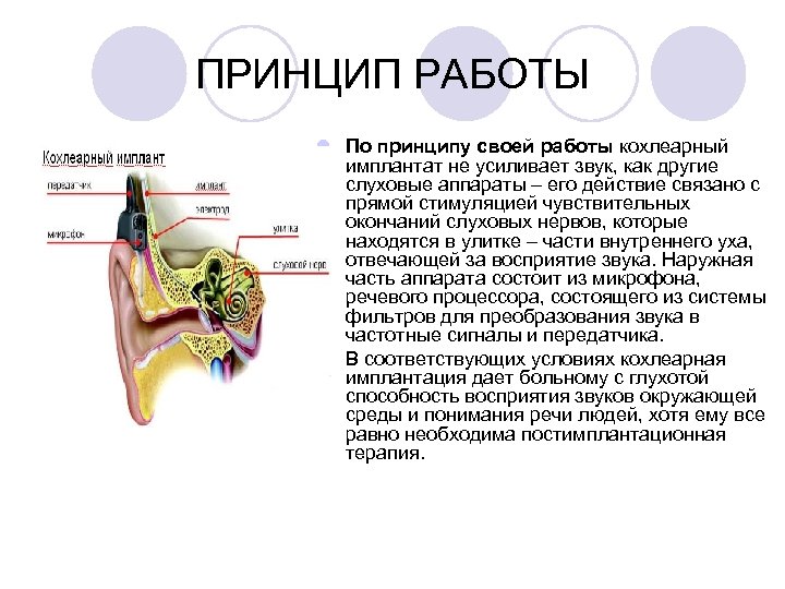 Презентация на тему слуховой аппарат