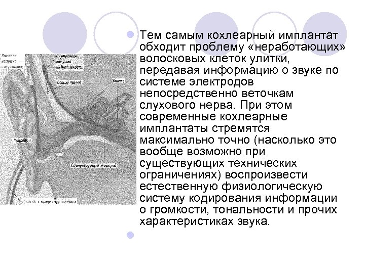 l Тем самым кохлеарный имплантат обходит проблему «неработающих» волосковых клеток улитки, передавая информацию о