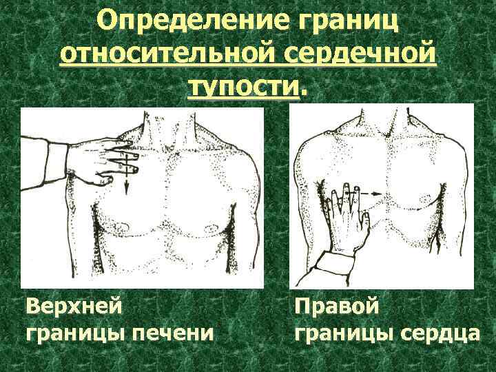 Правая граница печени. Границы печени. Перкуссия печени верхняя граница. Перкуссия печени верхняя и нижняя границы. Границы печени перкуссия.