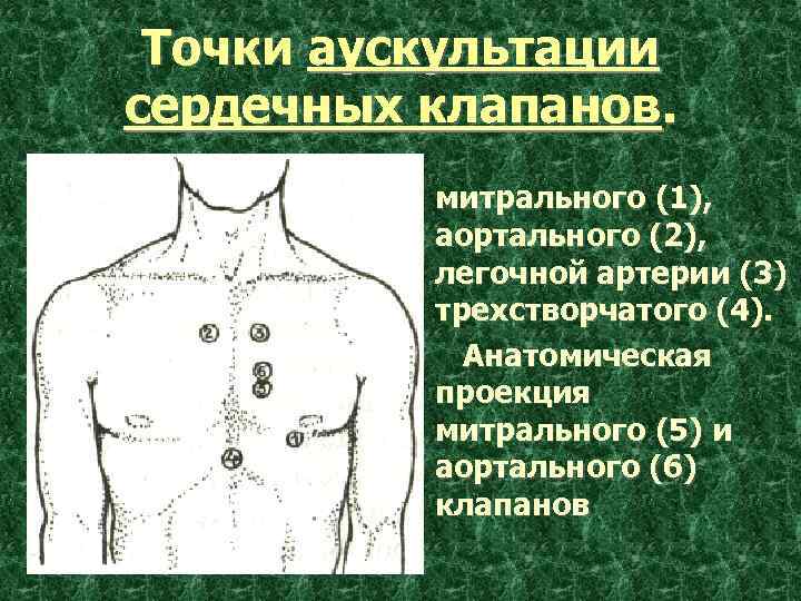 Точки аускультации сердечных клапанов. митрального (1), аортального (2), легочной артерии (3) трехстворчатого (4). Анатомическая