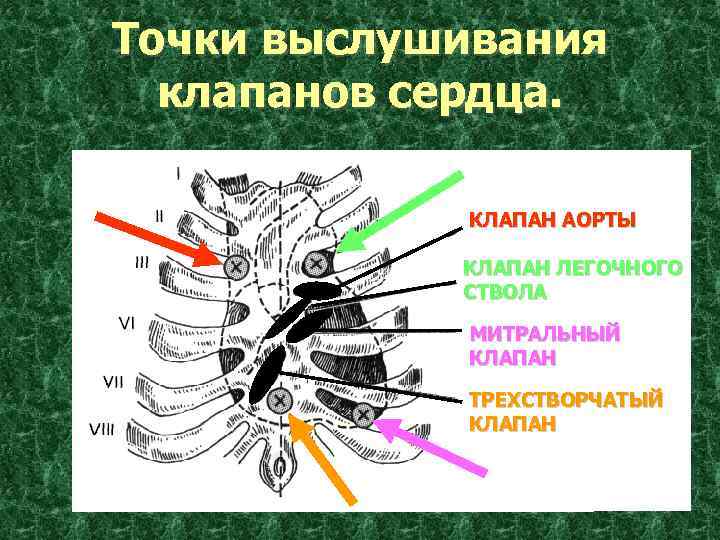 Точки выслушивания сердца