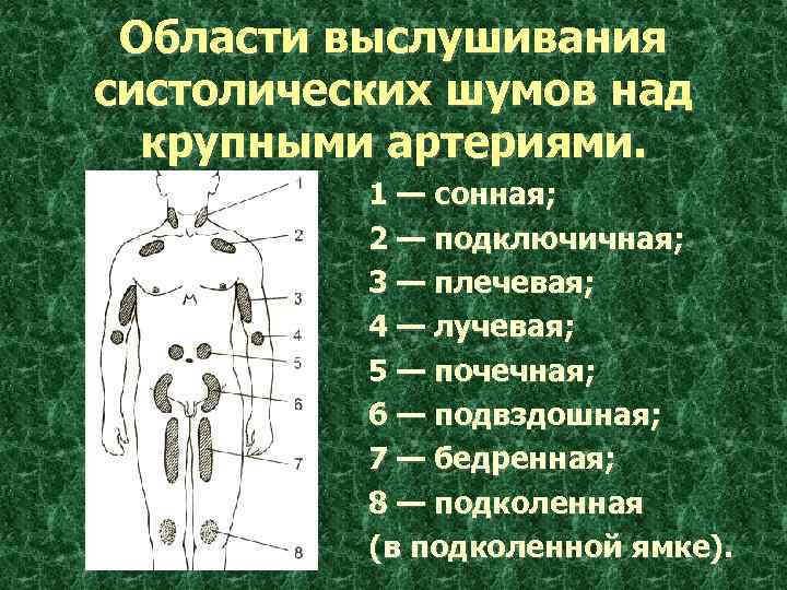 Области выслушивания систолических шумов над крупными артериями. 1 — сонная; 2 — подключичная; 3