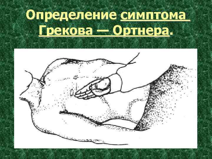 Выявление признаков. Симптомы Мерфи, Кера, Мюсси, Ортнера-Грекова.. Симптомы Мерфи, Ортнера-Грекова, Мюсси-Георгиевского. Симптом Ортнера Кера Мюсси Мерфи. Симптомы Кера Мерфи Ортнера.