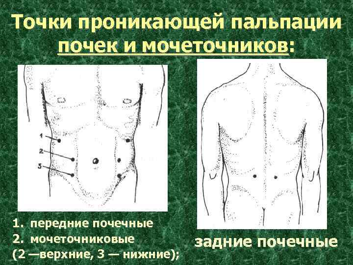 Мочеточниковые точки. Пальпация мочеточниковых точек пропедевтика. Пальпация мочеточниковых точек у детей. Болевые точки почек.