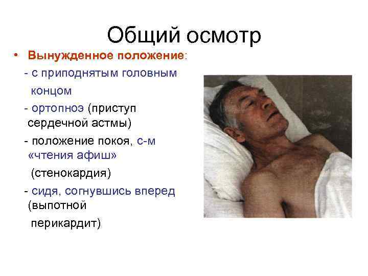 Общий осмотр • Вынужденное положение: - с приподнятым головным концом - ортопноэ (приступ сердечной