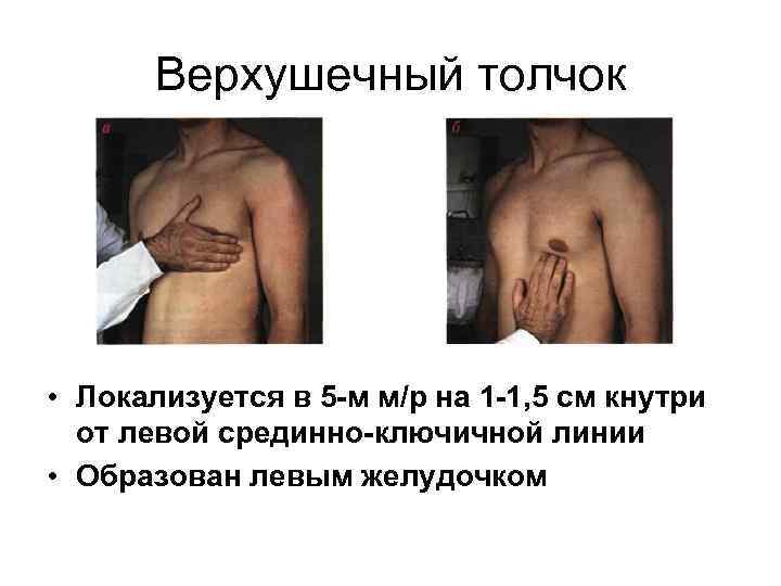 Верхушечный толчок • Локализуется в 5 -м м/р на 1 -1, 5 см кнутри