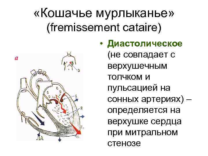  «Кошачье мурлыканье» (fremissement cataire) • Диастолическое (не совпадает с верхушечным толчком и пульсацией