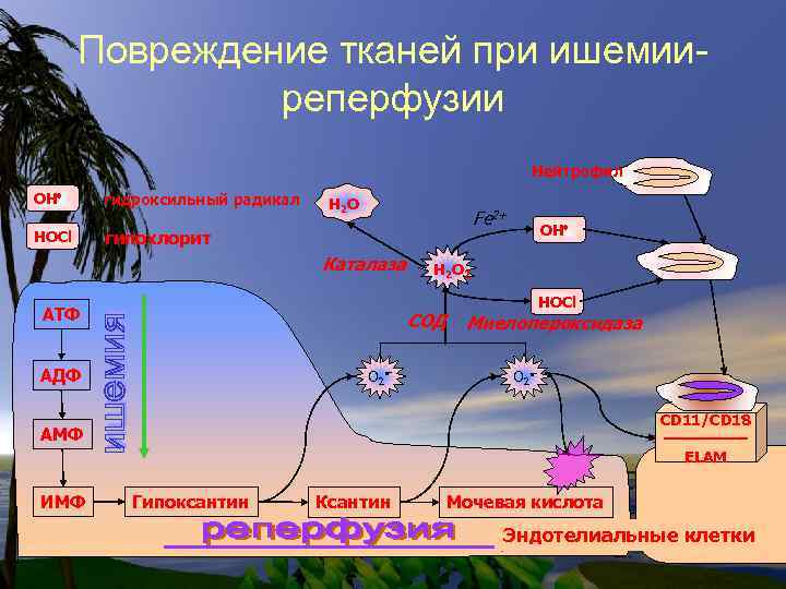 Повреждение тканей при ишемииреперфузии Нейтрофил OH - гидроксильный радикал HOCl - гипохлорит H 2