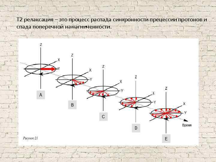 T 2 релаксация – это процесс распада синхронности прецессии протонов и спада поперечной намагниченности.