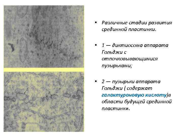  • Различные стадии развития срединной пластинки. • 1 — диктиосома аппарата Гольджи с