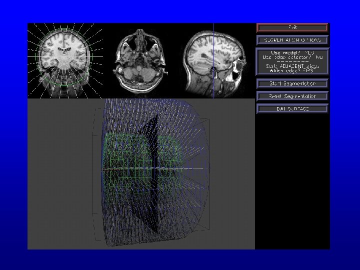 Initial model - lateral view 