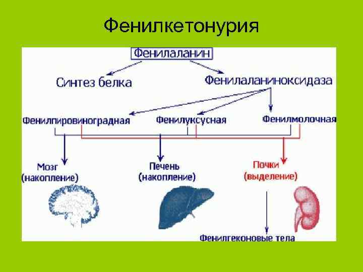Фенилкетонурия 