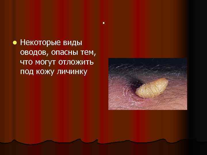 . l Некоторые виды оводов, опасны тем, что могут отложить под кожу личинку 