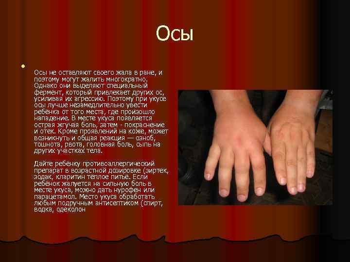 Осы l Осы не оставляют своего жала в ране, и поэтому могут жалить многократно.