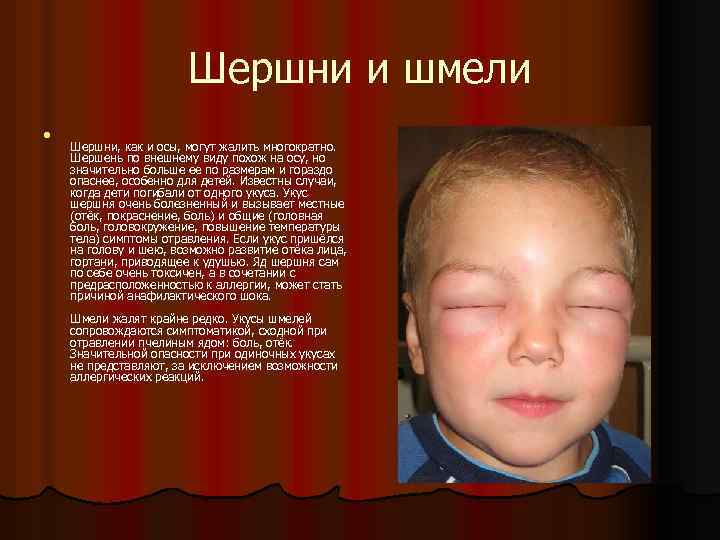 Шершни и шмели l Шершни, как и осы, могут жалить многократно. Шершень по внешнему