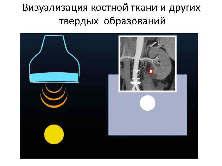 Визуализация костной ткани и других твердых образований 