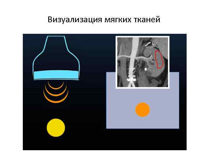 Визуализация мягких тканей 