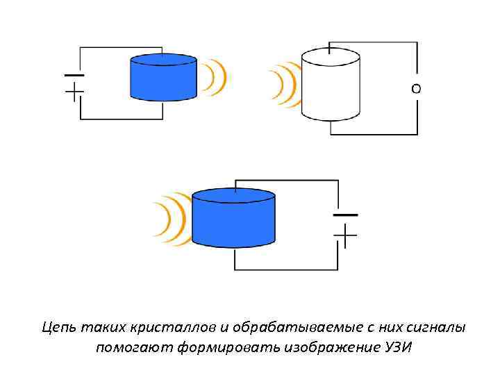 Цепь таких кристаллов и обрабатываемые с них сигналы помогают формировать изображение УЗИ 