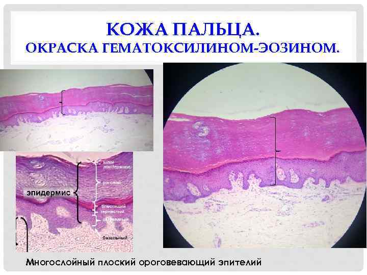 КОЖА ПАЛЬЦА. ОКРАСКА ГЕМАТОКСИЛИНОМ-ЭОЗИНОМ. Многослойный плоский ороговевающий эпителий 