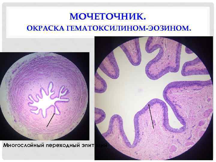 МОЧЕТОЧНИК. ОКРАСКА ГЕМАТОКСИЛИНОМ-ЭОЗИНОМ. Многослойный переходный эпителий 